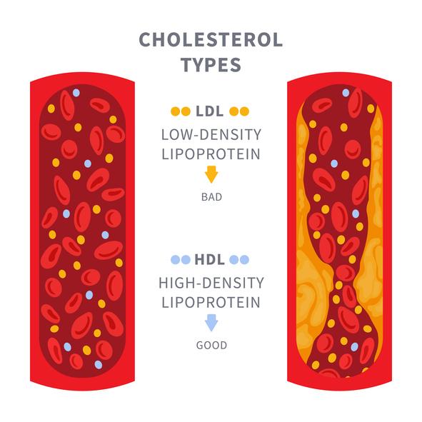 graphic of cholesterol types