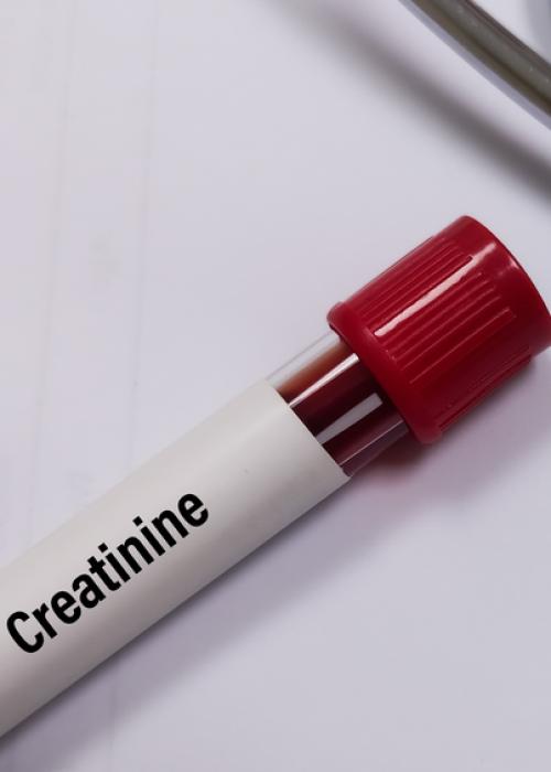 blood vial with creatinine label